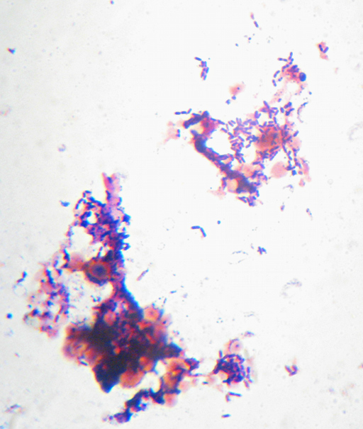 A Gram-stained view of yeasts and bacteria in a sourdough culture named 'Fred'.