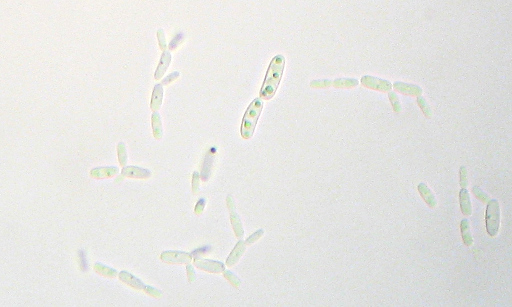 Unidentified yeast cultured from the flowering parts of a Lyreleaf sage (Salvia lyrata) - Brightfield image 400X magnification