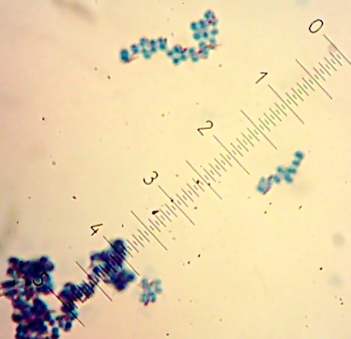 Sam the...Saccharomyces-type yeast?