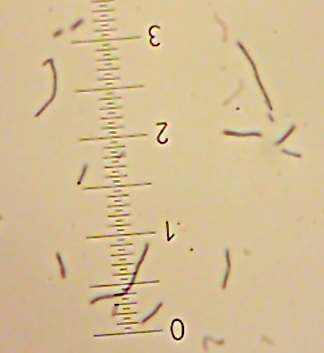 Sid the [lacto?]bacillus-type-thing