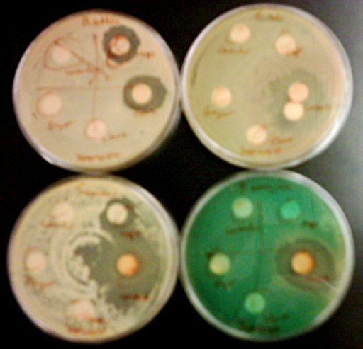 Petri dishes containing bacteria, showing inhibition of growth by certain substances